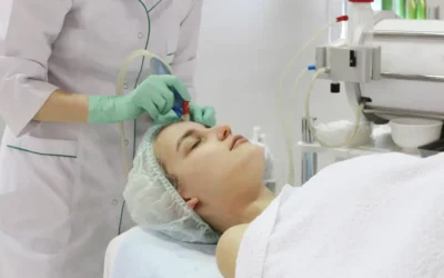 Jak przebiega zabieg radiofrekwencji mikroigłowej?